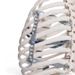 Park´s pectus System